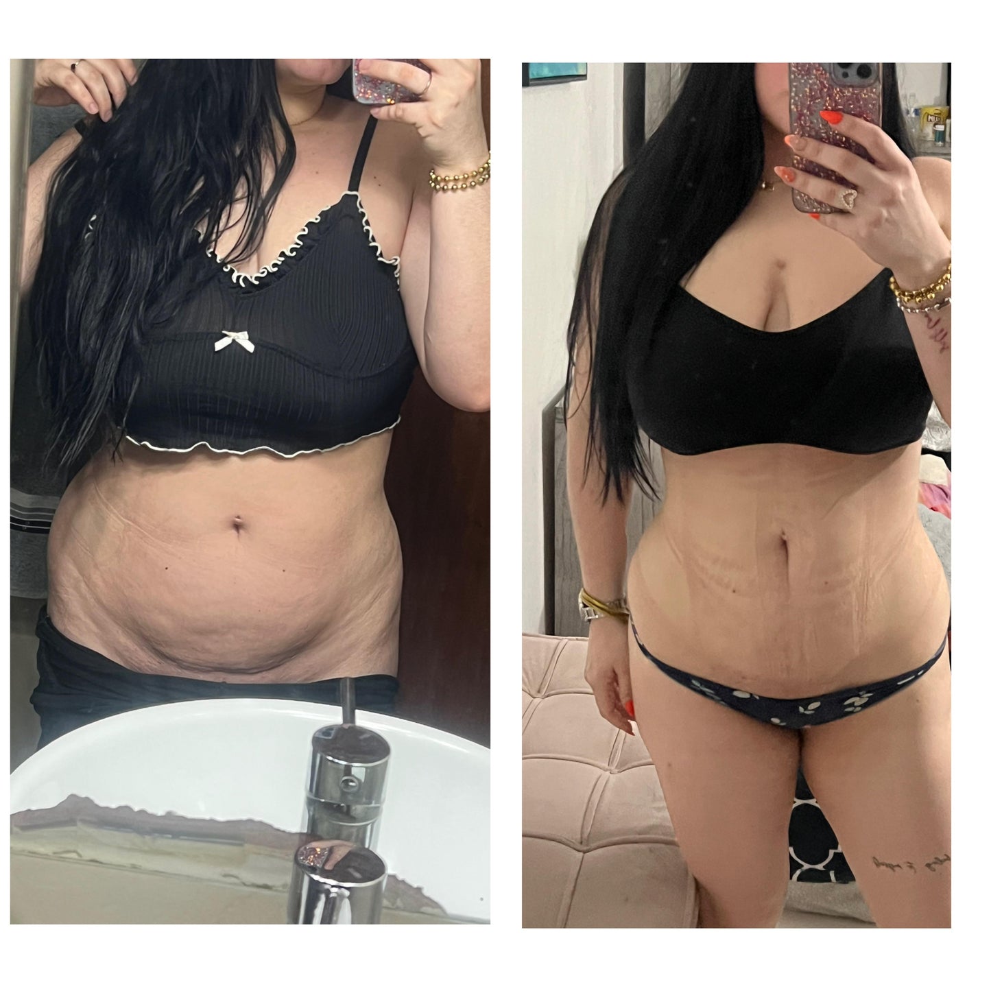 Weight Loss Capsule